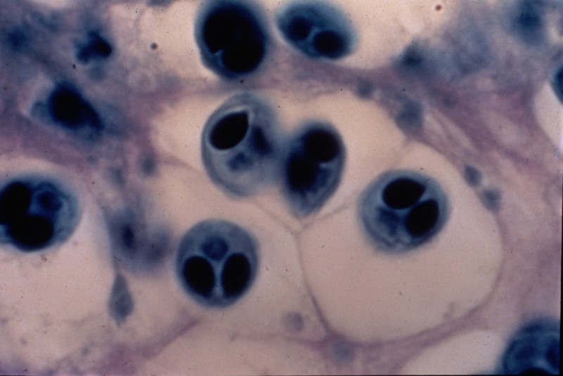 These alien-like spores can cause whirling disease, which causes heavy fatalities in fish. Image is public domain. 